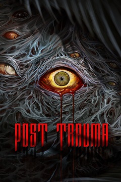 1745394366-catorrent-post_trauma.jpg